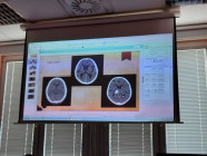 Návštěva iktového centra neurologického oddělení Litomyšlské nemocnice