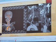 Návštěva iktového centra neurologického oddělení Litomyšlské nemocnice