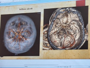 Návštěva iktového centra neurologického oddělení Litomyšlské nemocnice